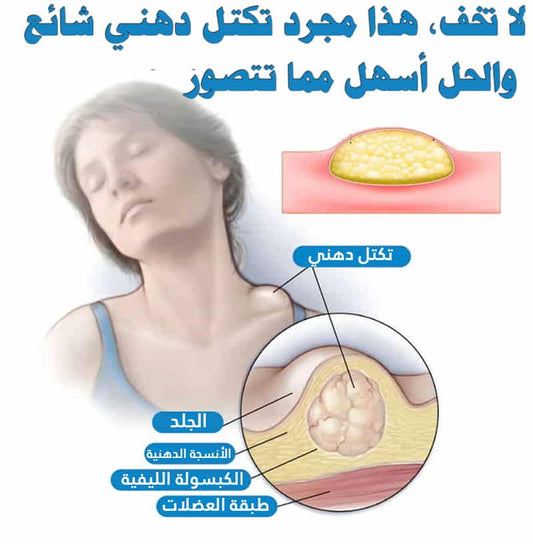 المهم هي النتيجة